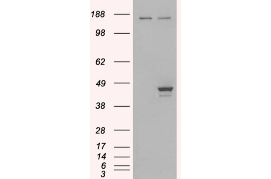 Western Blot - Anti-ESE1 Antibody (A83854) - Antibodies.com