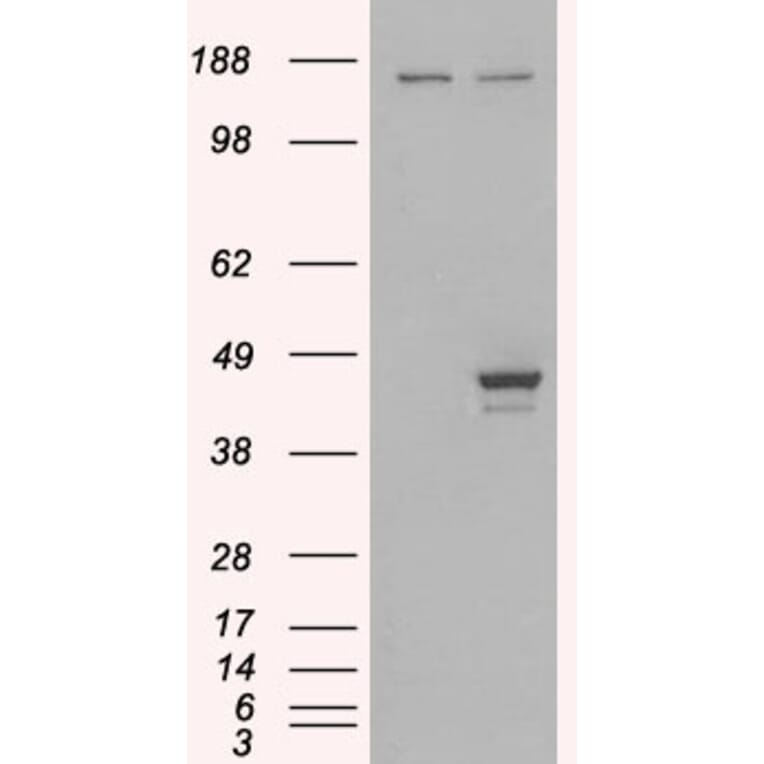 Western Blot - Anti-ESE1 Antibody (A83854) - Antibodies.com