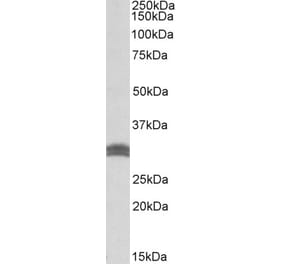 Western Blot - Anti-CBR1 Antibody (A83856) - Antibodies.com