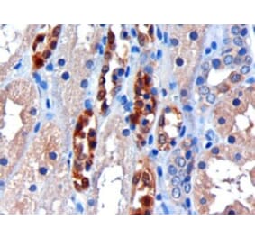 Immunohistochemistry - Anti-CBR1 Antibody (A83856) - Antibodies.com