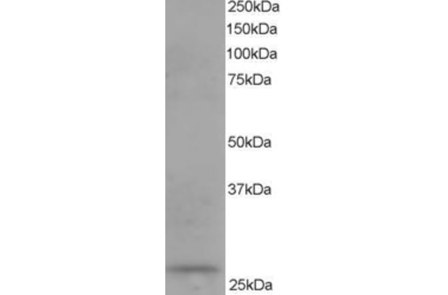 Western Blot - Anti-DCXR Antibody (A83858) - Antibodies.com