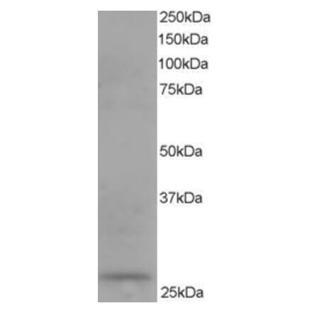 Western Blot - Anti-DCXR Antibody (A83858) - Antibodies.com