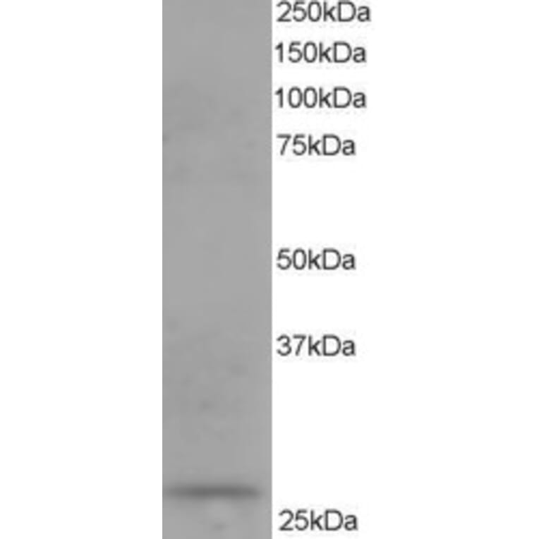 Western Blot - Anti-DCXR Antibody (A83858) - Antibodies.com