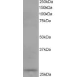Western Blot - Anti-DCXR Antibody (A83858) - Antibodies.com