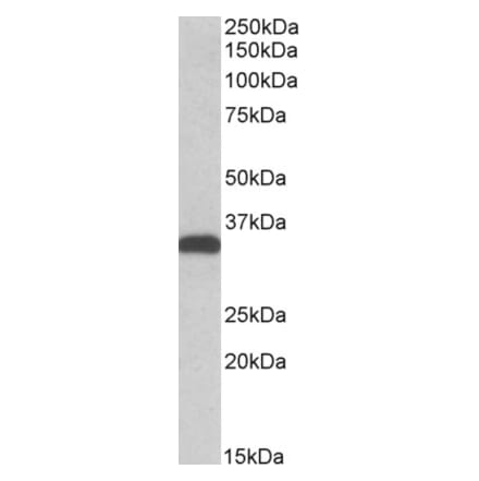 Western Blot - Anti-CBR3 Antibody (A83859) - Antibodies.com