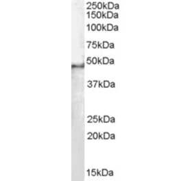 Western Blot - Anti-SF3B4 Antibody (A83860) - Antibodies.com