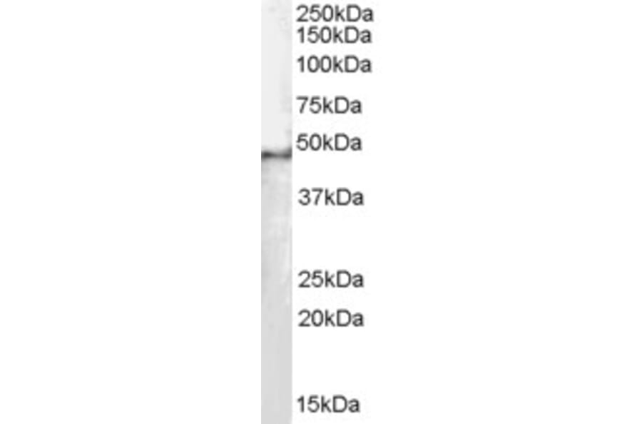 Western Blot - Anti-SF3B4 Antibody (A83860) - Antibodies.com