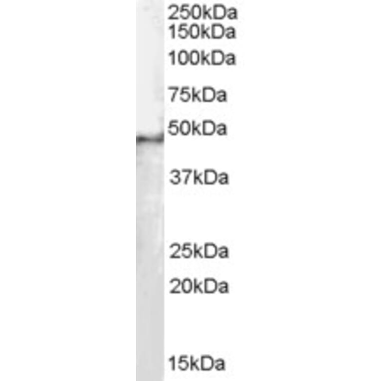 Western Blot - Anti-SF3B4 Antibody (A83860) - Antibodies.com