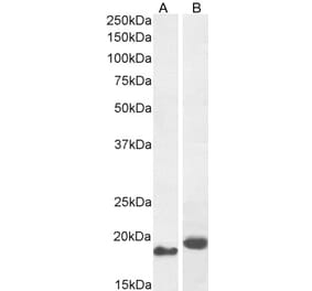 Western Blot - Anti-ARL2 Antibody (A83862) - Antibodies.com