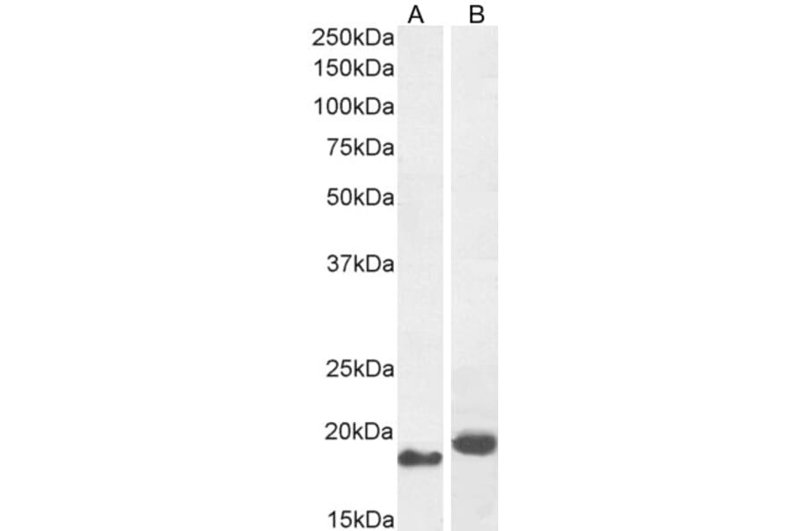 Western Blot - Anti-ARL2 Antibody (A83862) - Antibodies.com