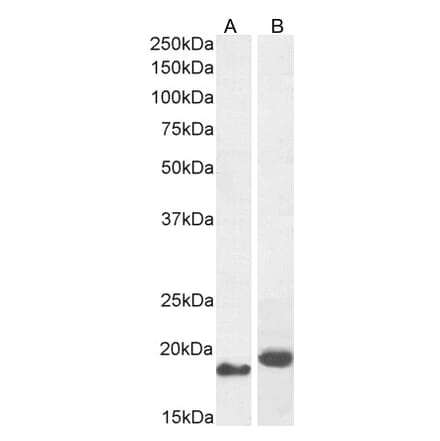 Western Blot - Anti-ARL2 Antibody (A83862) - Antibodies.com