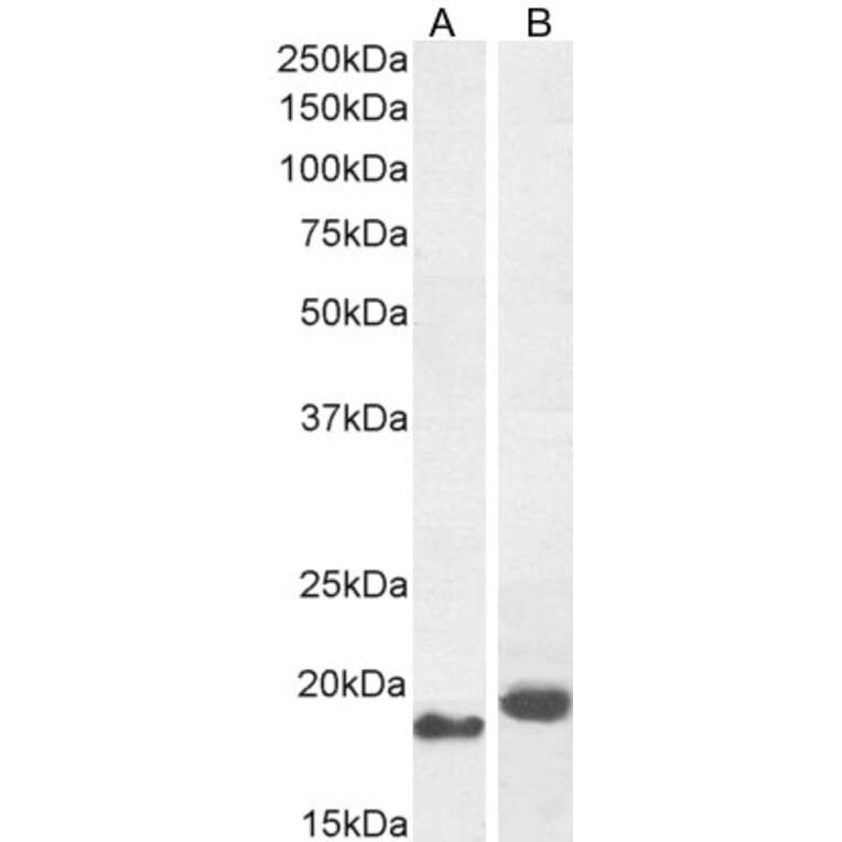 Western Blot - Anti-ARL2 Antibody (A83862) - Antibodies.com