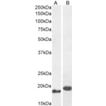 Western Blot - Anti-ARL2 Antibody (A83862) - Antibodies.com