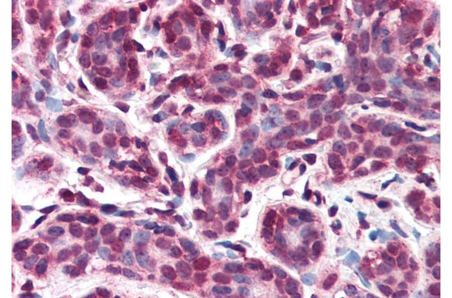 Immunohistochemistry - Anti-IPO7 Antibody (A83863)