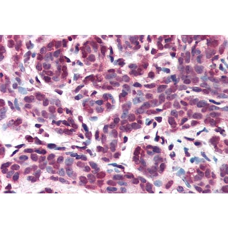 Immunohistochemistry - Anti-IPO7 Antibody (A83863)