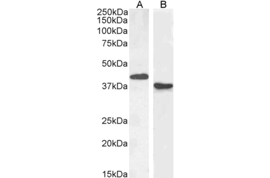 Western Blot - Anti-PAX5 Antibody (A83864) - Antibodies.com