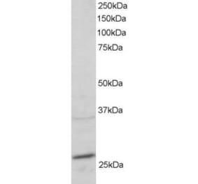 Western Blot - Anti-Rab11A Antibody (A83865) - Antibodies.com