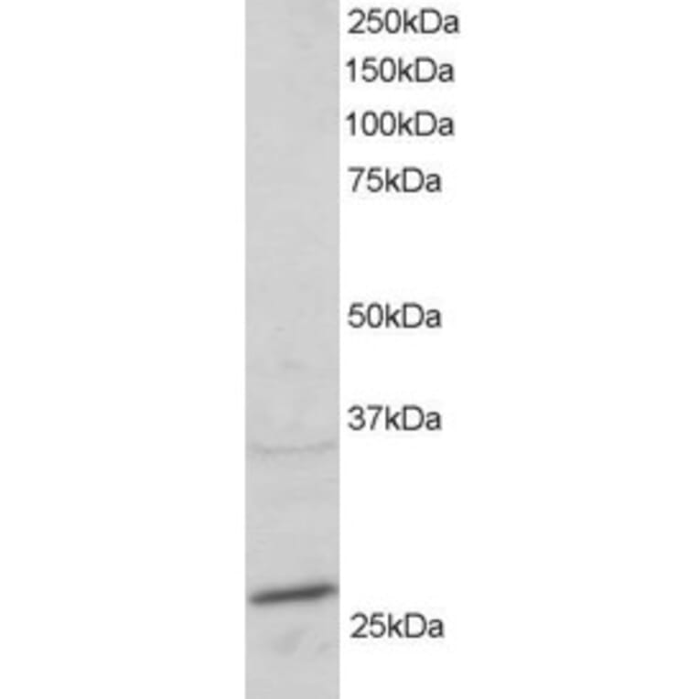 Western Blot - Anti-Rab11A Antibody (A83865) - Antibodies.com