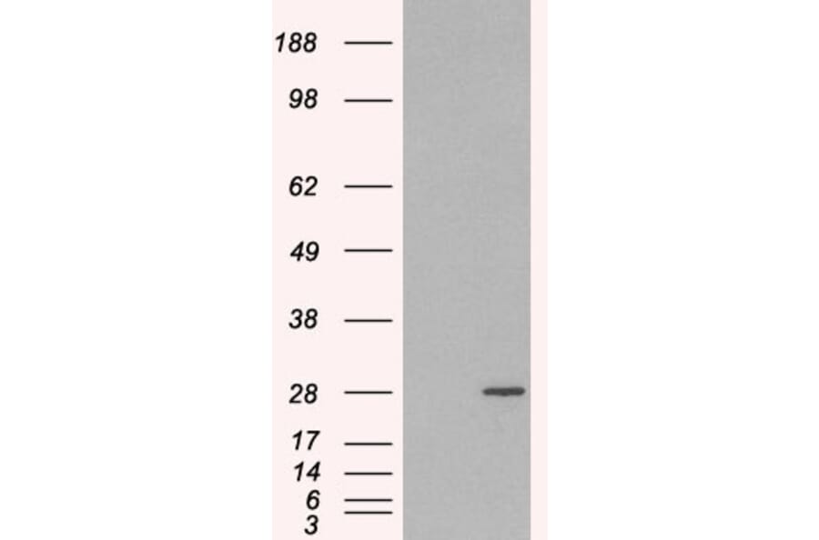 Western Blot - Anti-Rab11A Antibody (A83865) - Antibodies.com