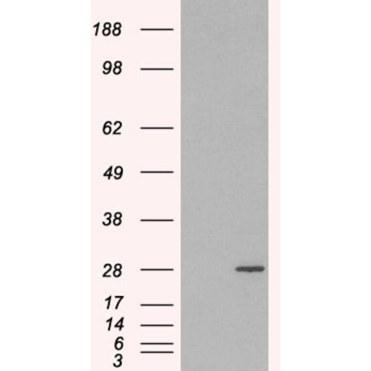 Western Blot - Anti-Rab11A Antibody (A83865) - Antibodies.com