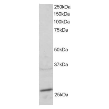 Western Blot - Anti-RAB11A Antibody (A83865) - Antibodies.com