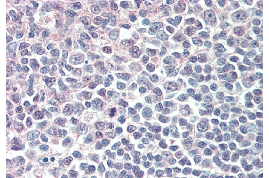 Immunohistochemistry - Anti-IRF8 Antibody (A83867) - Antibodies.com