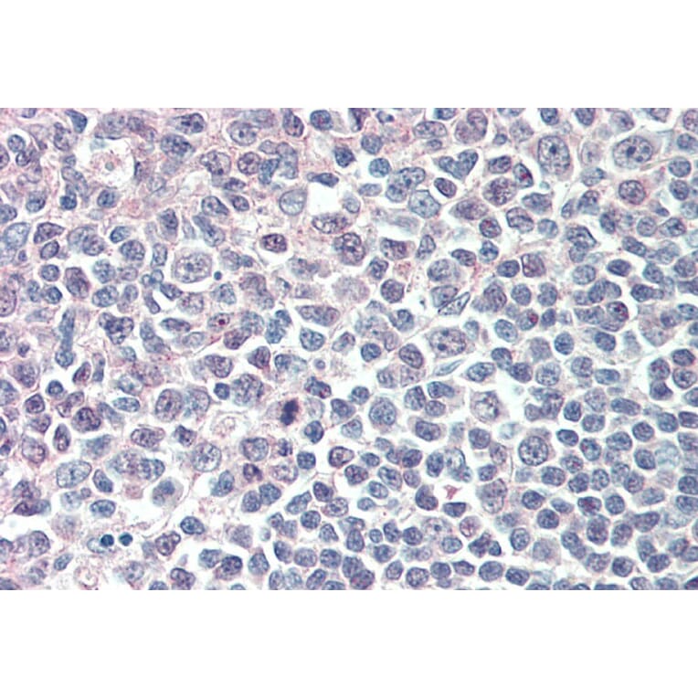 Immunohistochemistry - Anti-IRF8 Antibody (A83867) - Antibodies.com