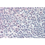 Immunohistochemistry - Anti-IRF8 Antibody (A83867) - Antibodies.com