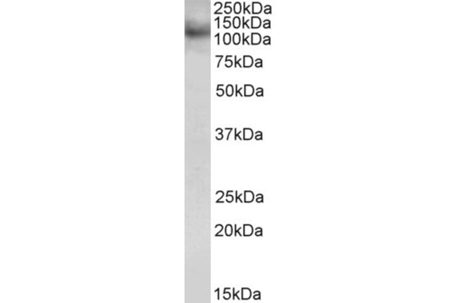 Western Blot - Anti-RNF31 Antibody (A83868) - Antibodies.com
