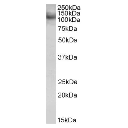 Western Blot - Anti-RNF31 Antibody (A83868) - Antibodies.com