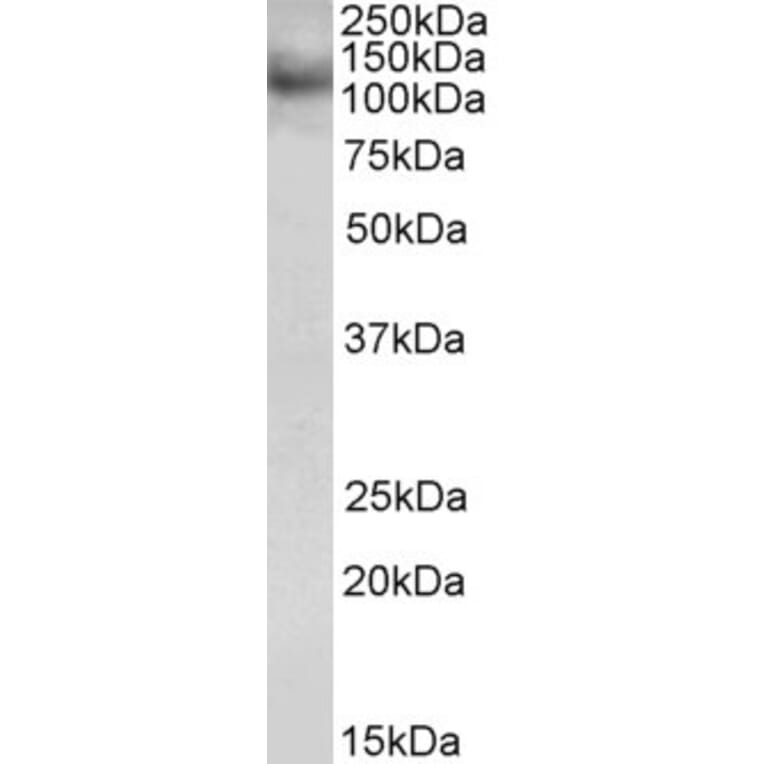 Western Blot - Anti-RNF31 Antibody (A83868) - Antibodies.com