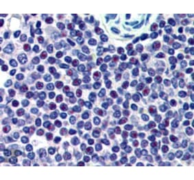 Immunohistochemistry - Anti-HMG20A Antibody (A83870) - Antibodies.com