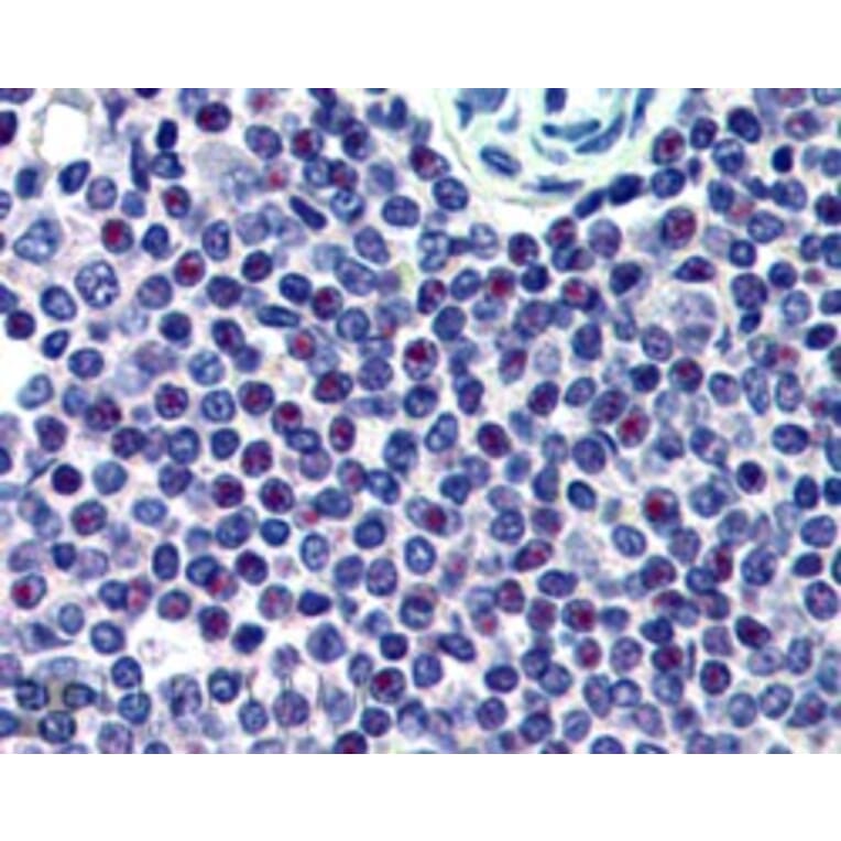 Immunohistochemistry - Anti-HMG20A Antibody (A83870) - Antibodies.com