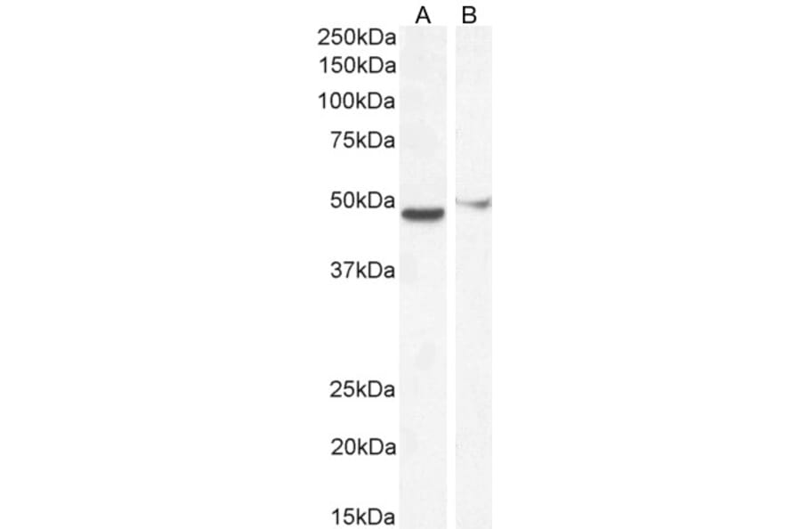 Western Blot - Anti-FOXG1 Antibody (A83872) - Antibodies.com