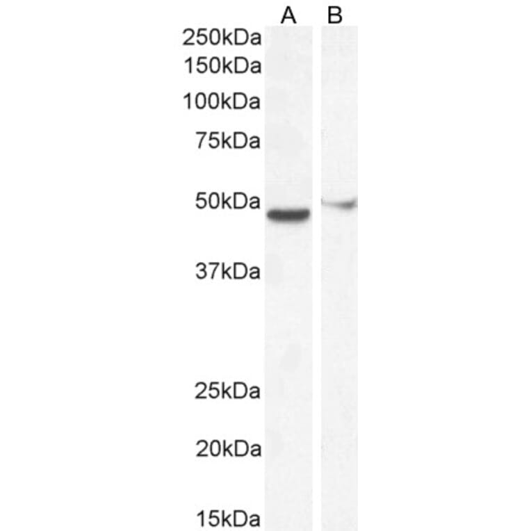 Western Blot - Anti-FOXG1 Antibody (A83872) - Antibodies.com