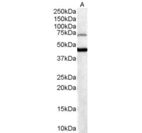 Western Blot - Anti-FOXG1 Antibody (A83872) - Antibodies.com