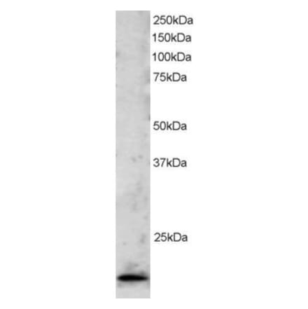 Western Blot - Anti-TBP Like 1 Antibody (A83875) - Antibodies.com