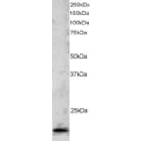 Western Blot - Anti-TBP Like 1 Antibody (A83875) - Antibodies.com