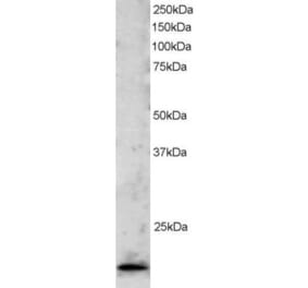 Western Blot - Anti-TBPL1 Antibody (A83875) - Antibodies.com