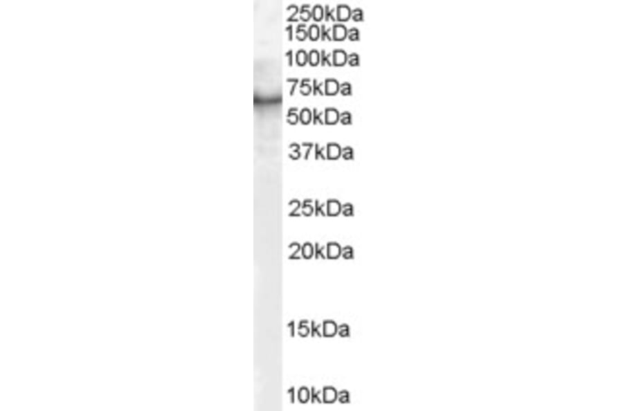 Western Blot - Anti-S6K1 Antibody (A83877) - Antibodies.com