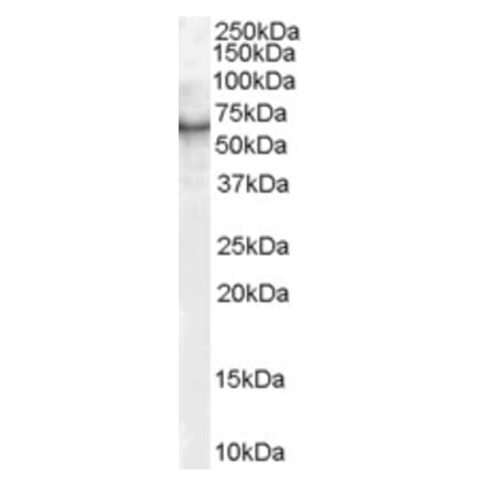 Western Blot - Anti-S6K1 Antibody (A83877) - Antibodies.com