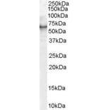 Western Blot - Anti-S6K1 Antibody (A83877) - Antibodies.com