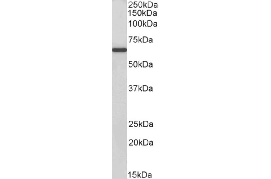 Western Blot - Anti-S6K1 Antibody (A83877) - Antibodies.com