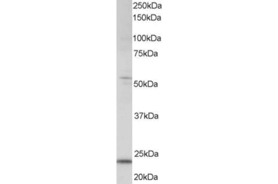 Western Blot - Anti-MXD4/MAD4 Antibody (A83879) - Antibodies.com