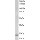 Western Blot - Anti-MXD4/MAD4 Antibody (A83879) - Antibodies.com