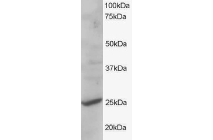 Western Blot - Anti-CYB561D2 Antibody (A83880) - Antibodies.com
