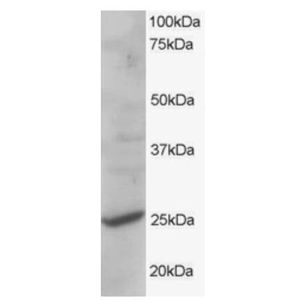 Western Blot - Anti-CYB561D2 Antibody (A83880) - Antibodies.com