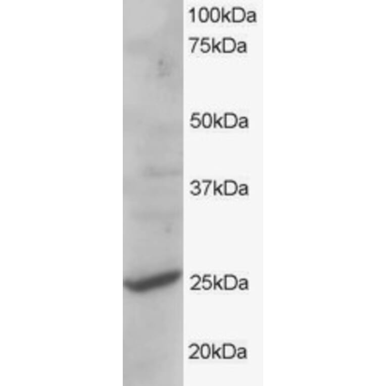 Western Blot - Anti-CYB561D2 Antibody (A83880) - Antibodies.com