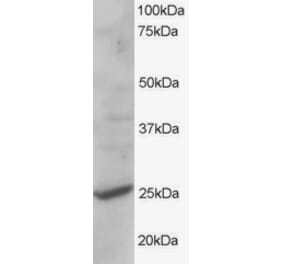 Western Blot - Anti-CYB561D2 Antibody (A83880) - Antibodies.com