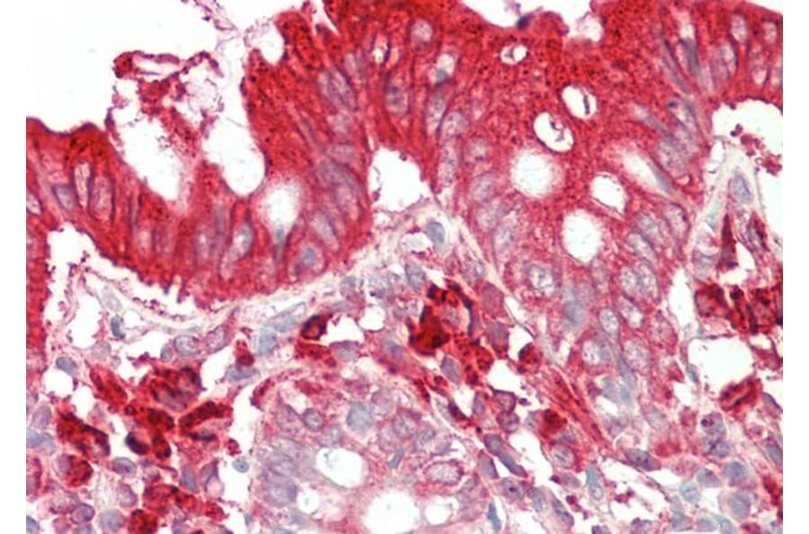 Immunohistochemistry - Anti-TFB2M Antibody (A83881) - Antibodies.com